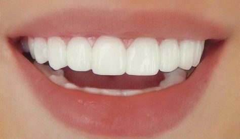 Teeth Aesthetic, Pretty Teeth, Studera Motivation, Wish Board, Perfect Teeth, Dream Vision Board, Vision Board Manifestation, Beauty Goals, Healthy Lifestyle Inspiration