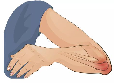 Elbow Bursitis, Bursitis Exercises, Bursitis Elbow, Forearm Anatomy, Tennis Elbow Relief, Elbow Pain Relief, Osteoporosis Exercises, Dry Elbows, Elbow Pain