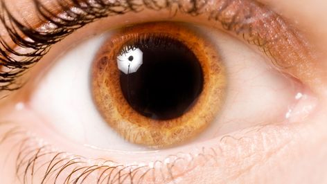 Are dilated pupils a cause for concern? Pupil Dilation, Lying Eyes, Dilated Pupils, Adrenergic Receptors, Alcohol Withdrawal, Droopy Eyelids, Parts Of The Eye, Cranial Nerves, Blurry Vision