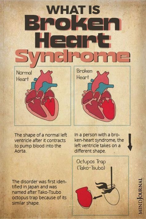 Healing From Heartache, Can You Feel My Heart, Love Syndrome, Heart Facts, Emotion Code, Breakup Hurt, Heart Fail, Heart Pain, Broken Hearts Club