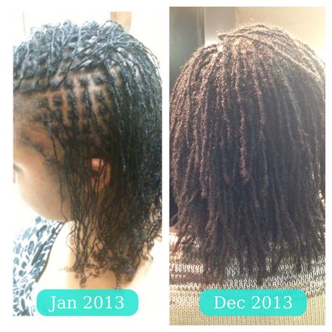 One Year loc texture difference! One month into my braidlocs, and I'm just waiting for mine to get thicker, so they will look fuller, I don't even care about length I just want fullness at this point. Braidlocs Journey, How To Retie Microlocs, Caring For Microlocs, Instant Dreads, Micro Interlocks, How To Start Dreadlocks, Starting Dreads, Microlocs Vs Sisterlocks, Microlocs Retie