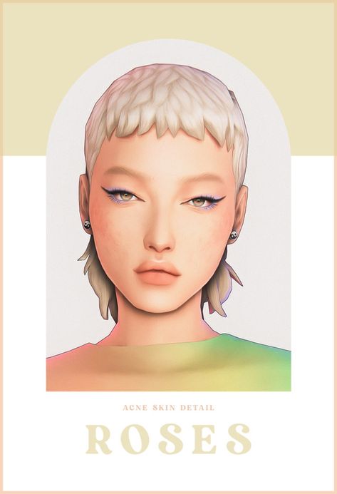 Ts4mm Skin, Sims 4 Acne Maxis Match, S4mm Skin Details, Maxis Match Sims 4 Cc Freckles, Sims 4 Cc Acne Maxis Match, Sims 4 Skin Details Acne, Ts4 Acne Cc, Sims 4 Cc Skin Acne, Sims 4 Cc Cartoon Skin