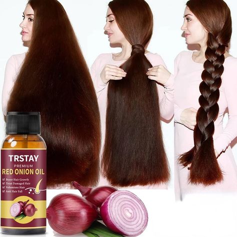 Onion Hair Oil is enriched with antibacterial properties, which contribute to maintaining a healthy scalp. This, in turn, supports an uninterrupted hair growth cycle. Hair Oil Spray, Healthy Steak Recipes, Hair Oil For Hair Growth, Healthy Steak, Stimulating Hair Growth, Herbs For Hair Growth, Treat Damaged Hair, Herbal Hair Growth, Cold Fusion