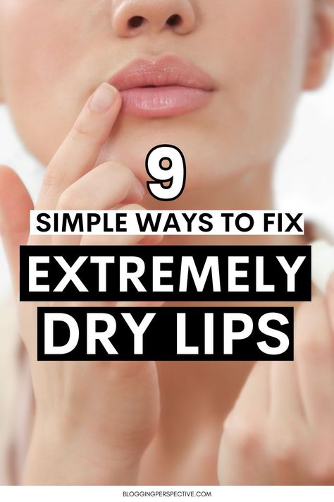 Say goodbye to dry lips with our proven dry lips remedies. Learn how to maintain soft, hydrated lips with our easy lip care tips. Perfect your pout and keep chapped lips at bay by visiting our blog today! How To Make Lips Soft, How To Keep Lips Hydrated, How To Fix Dry Lips, Chapped Lips Remedy Severe, Dry Lips Remedy Overnight, How To Make Your Lips Soft, Soft Lips Tips, Lips Remedies, Dry Lips Remedy