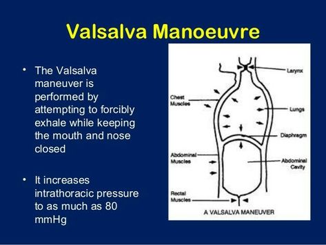 Valsalva maneuver Anatomy Infographic, Nursing Facts, Valsalva Maneuver, Medical Notes, Fluid And Electrolytes, Nursing Notes, Nclex, Biochemistry, Medical Students