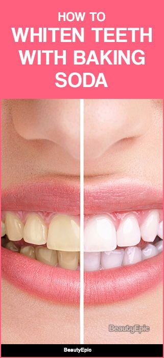 Teeth Whitening At Home, Teeth Whitening Diy, Tips For Oily Skin, Dental Cavities, Diy Teething, Tooth Enamel, Baking Soda Uses, Baking Soda Shampoo, Oral Care Routine