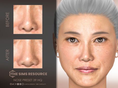 The Sims Resource - Nose Preset 39 HQ Cc Skin Sims 4, Sims 4 Cc Nose, Presets Sims 4, Sims 4 Miscellaneous, Sims 4 Presets, Sims 4 Genetics, Sims 4 Content, Sims 4 Challenges, Wide Nose