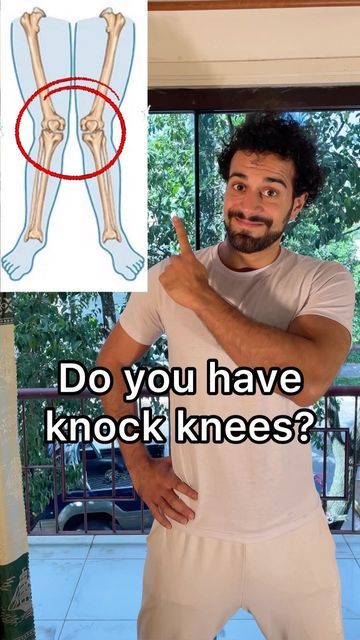 Knee Pain Remedies, Knock Knees Exercises, Knock Knees, Leg Workout Routine, Knee Pain Exercises, Yoga Beginners, Knee Exercises, Quick Workout Routine, Effective Workout Routines