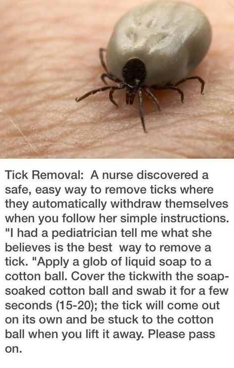 1000 Lifehacks, Tick Removal, Tick Repellent, Camping Checklist, Simple Life Hacks, Diy Life Hacks, Back To Nature, Survival Tips, Useful Life Hacks