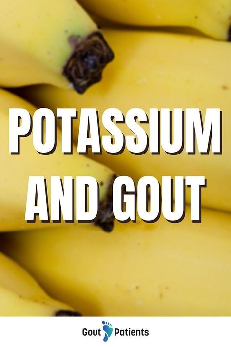 Dive into the fascinating world of nutrition and health as we explore how potassium can play a crucial role in managing gout symptoms. Learn about the science behind potassium's impact on uric acid levels and how incorporating potassium-rich foods into your diet might help alleviate discomfort. Whether you're seeking natural remedies or simply curious about dietary influences on gout, this guide offers valuable insights and practical tips for enhancing your well-being. Uric Acid Diet Food, Low Uric Acid Diet, Uric Acid Remedy, Uric Acid Symptoms, Potassium Benefits, Uric Acid Diet, Uric Acid Levels, Potassium Rich Foods, Pain Relief Remedies