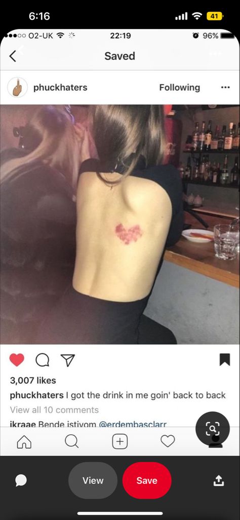 Heart Made Of Hickeys, Hickies Neck, Love Bites, Couple Goals Teenagers, Couples Vibe, Boyfriend Goals, Cute Couples Kissing, Relationship Goals Pictures, Cute Relationship Goals