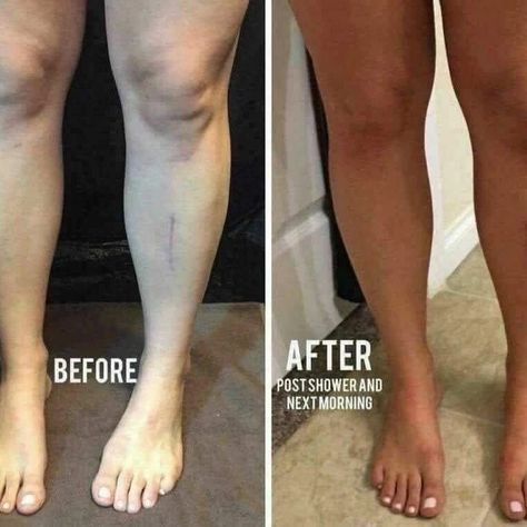 ✨ Achieve that sun-kissed glow effortlessly with our specially formulated tanning gel for the face! 🌟 Say goodbye to clogged pores and hello to a flawless tan! 💁‍♀️ Buildable for your desired shade, add more coats for a darker tan without the worry of streaks! ✨ Check out Kristen's right leg after just 2 coats – instant radiance! 🌞 Lasting up to 7 days, it fades naturally, leaving you with a seamless tan. Plus, our tinted gel formula delivers instant color for that instant confidence boost! ✨... Tanning Photos, Tan Before And After, Salon Photography, Spray Tan Tips, Tanning Studio, Fertility Tea, Pageant Tips, Loving Tan, Body Bronzer