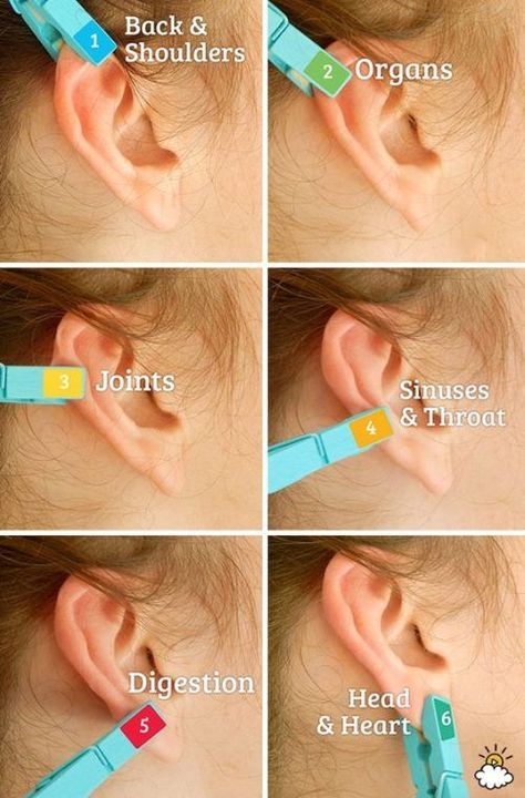 Ear Reflexology, Reflexology, Health Info, Acupressure, Health And Beauty Tips, Natural Medicine, Alternative Medicine, Massage Therapy, Acupuncture