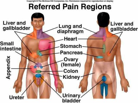 Referred pain chart Referred Pain, Health Chart, Psoas Muscle, Cupping Therapy, Medical Anatomy, Nursing Notes, Abdominal Pain, Shoulder Pain, The Human Body