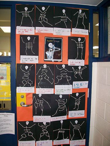 Skeleton Hiccups-Lukas' teacher made this adorable bulletin board with the kindergarteners. They used Q-Tips. Then, they wrote what they would say to a skeleton that had the hiccups. So cute! Human Body Bulletin Board Ideas, Skeleton Hiccups Activities, Preschool Human Body Theme, Skeleton Bulletin Board, Skeleton Hiccups, Reggio Kindergarten, Buddy Activities, Halloween School Activities, Pe Bulletin Boards