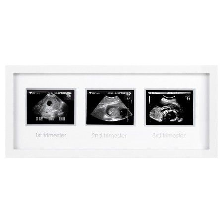 Sonogram Picture Frame, Sonogram Pictures, Baby Picture Frames, Ultrasound Pictures, Gifts For Expecting Parents, Baby Sleep Problems, Baby Arrival, Pregnant Mom