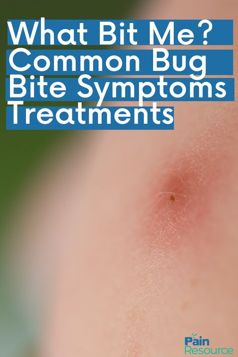 Bug Bites Identifying Chart, Dust Mites Bites, Types Of Bug Bites, Spider Bite Symptoms, Swelling Remedies, Asian Beetle, Itchy Bug Bites, Spider Bite, Types Of Spiders