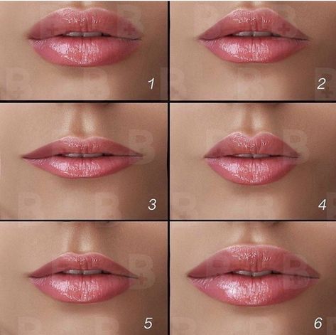 Types Of Lips Shape, Dermal Fillers Lips, Juvederm Lips, Lips Inspiration, Lip Types, Botox Lips, Perfect Nose, Facial Fillers, Cosmetic Injectables