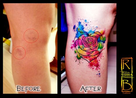 varicose vein cover up watercolor tattoo Skin Color Tattoos, Lower Leg Tattoos, Foot Tattoos For Women, Tattoos For Women Flowers, With Tattoo, Hand Tattoos For Women, Tattoo Cover-up, Cover Up Tattoos, Flower Tattoo Designs