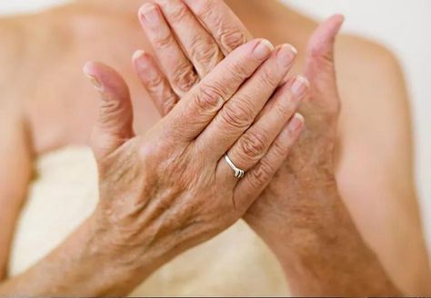 How To Make Your Hands Look Younger How To Make My Hands Look Younger, How To Keep Hands Youthful, How To Make Hands Look Younger, Make Hands Look Younger, Younger Hands, Best Hand Cream, Skin Tightening Remedies, Ways To Look Younger, Skin Removal Surgery