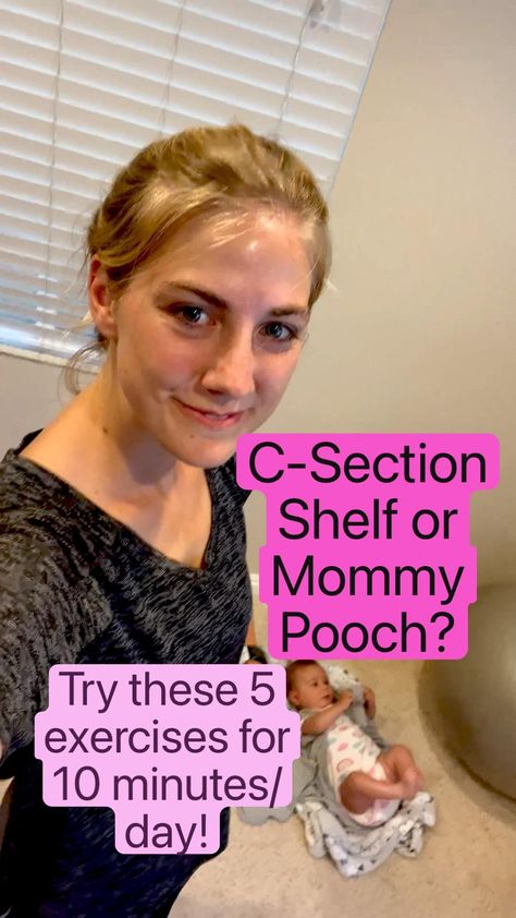 4 Week Post Csection Workout, Workouts For Csection Moms, Yoga For C Section Recovery, Post C Section Yoga, Postpartum Csection Workouts, Exercises For C Section Belly, Post Csection Ab Workouts, Exercise For Post C Section, Postpartum Workout After C Section