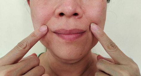 How to Get Rid of Smoker's Lines: 7 Best Methods How To Age Gracefully, Natural Skincare Ingredients, Bio Skin Care, Smokers Lines, Creepy Skin, Mouth Wrinkles, Premature Wrinkles, Food For Glowing Skin, Natural Skin Care Ingredients