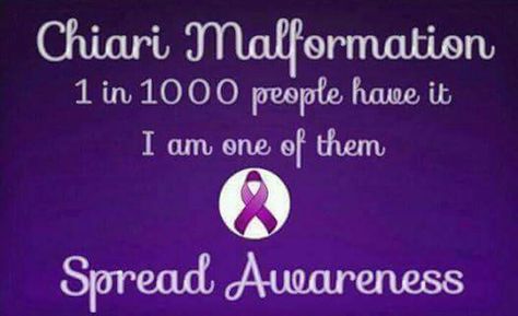 :) Pituitary Tumor, Chiari Malformation Awareness, Chiari Malformation, Brain Facts, Brain Surgery, Nerve Damage, Headache Relief, Migraine Headaches, Neurological Disorders