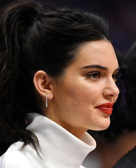 acne is NORMAL” • Jan 15, 2021 at 12:28pm UT Kendall Jenner Earrings, Kendall Jenner Face, Kendall Jenner Icons, Skin Aesthetics, La Clippers, Staples Center, 4th November, Keeping Up With The Kardashians, Kendall And Kylie Jenner