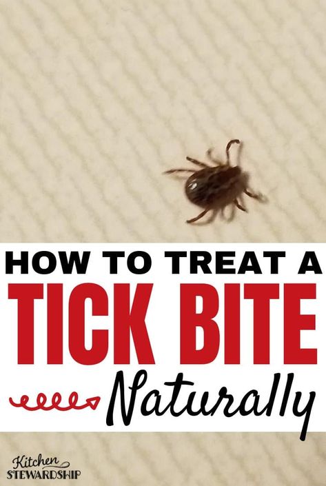 How to Treat a Tick Bite Naturally - What to do After Removing a Tick: Find out how to treat a tick bite naturally, and should you save the tick for testing? Are antibiotics necessary after all tick bites? Tick Bites Pictures, How To Remove Ticks From People, Essential Oils For Tick Bites, Deer Tick Bite, Tick Spray Essential Oils, Tick Bite Symptoms, Essential Oils For Ticks On Dogs, How Do You Remove A Tick From A Dog, Types Of Ticks