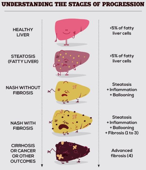 Liver Cleanse Juice, Healthy Liver Diet, Kidney Detox, Lemon Diet, Liver Diet, Liver Failure, Healthy Liver, Body Organs, Liver Health