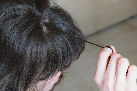 Medical therapy should be paired with behavioral therapy to best treat this distressing hair-pulling disorder, researchers claim. Pulling Hair Out, Skin Picking Disorder, Hairstyles Anime, Henna Cones, Amy Schumer, Regrow Hair, Hair Pulling, Pink Skin, Anime Hair