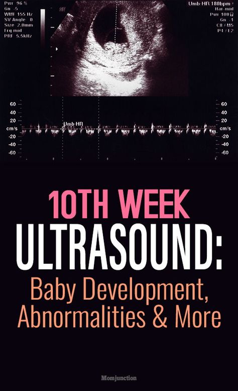 10th Week Ultrasound: Baby Development, Abnormalities And More : As your baby continues to grow in many ways, it is time for yet another prenatal check-up that includes an ultrasound. To know what to expect during a week 10 ultrasound scan and understand the baby development at this stage, read this MomJunction post. #pregnancy #healthypregnancy #pregnancycare #1othweekpregnancy 10 Week Ultrasound Pictures, 10 Weeks Pregnant Ultrasound, 9 Week Ultrasound, 10 Week Ultrasound, 10 Weeks Pregnant, Pregnancy Ultrasound, First Ultrasound, Pregnancy Progression, Gestational Age