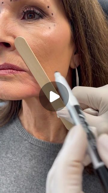 Lip Injection Techniques, Lip Flip Vs Filler, Botox Around Mouth, Marionette Lines Filler, Lip Line Filler, Botox Business, Facial Muscles Anatomy, Upper Lip Wrinkles, Botox Injection Sites