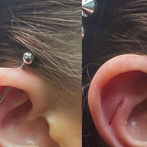 @piercing_gone_wrong on Instagram: "#industrialpiercing #industrialpiercings #piercing #piercings #pierced #piercinggonewrong #piercinggunsuck #piercingfail" Bad Piercings Funny, Tough Piercing, How To Clean Industrial Piercing, Piercing Whisper, Piercing Memes Funny, Bad Tattoos, Gone Wrong, Piercings, Tattoos