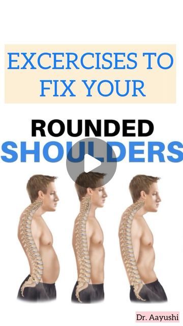 Dr.Aayushi Jain on Instagram: "Fix your Rounded Shoulders💯
Is your upper back too curved or do you have something what we call as an increased Kyphosis?
Try these 2 basic strengthening excercises for your upper back to correct your posture!

Let me know if they help💯✨

#upperbodyworkout #upperback #roundedshoulders #backpain #neckpain #posture #posturecorrection #strengthtraining #shoulderworkout #therabandworkout #wfh #postureexercises" Rounded Shoulders, Posture Exercises, Body Posture, Posture Correction, Improve Posture, Shoulder Workout, Upper Body Workout, Neck Pain, Fix You