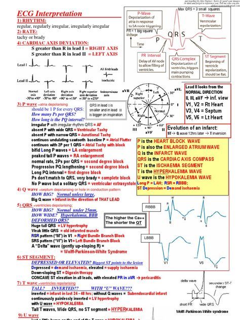 ECG Interpretation Cheat Sheet - Download as PDF File (.pdf), Text File (.txt) or read online. Nursing School Studying Cheat Sheets, Emt Study, Ekg Interpretation, Nursing Cheat Sheet, Ecg Interpretation, Nursing Cheat, Nursing School Essential, Nursing Study Guide, Medicine Notes