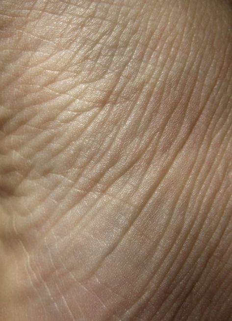 Free Texture Tuesday: Skin Texture Face Skin, Skin Texture Skincare, Wrinkles Photography, Flesh Texture, Human Skin Texture Photography, Real Skin Texture, Animal Texture Skin, Human Skin Texture, Body Imperfections