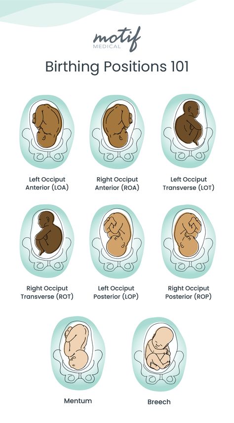 Discover and learn about optimal birthing positions with our midwife in the latest blog! 🤰 Get a FREE birthing chart and valuable tips on locating your baby in your body. Link in bio to learn more about birthing positions before labor. #pregnancytips #motifmedical #labortips #babypositions Birth Assistant, Birth Positions Natural, Labour Positions, Birth Positions, Free Birth, Labor Tips, Birthing Positions, Exercises To Prepare For Birth, Labor And Delivery