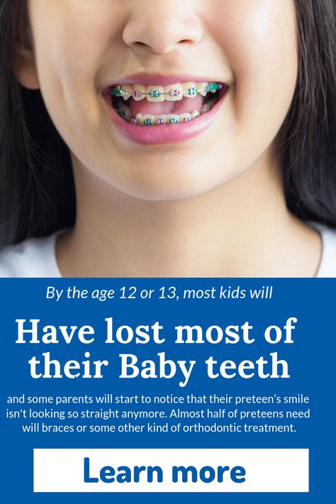 Most kids will have lost all of their baby teeth by the age of 12 or 13. You might notice your preteen's smile is not so straight! Find out if your child needs braces Braces For Kids, Braces Smile, Kids Braces, Baby Teeth, Ads Creative, Braces