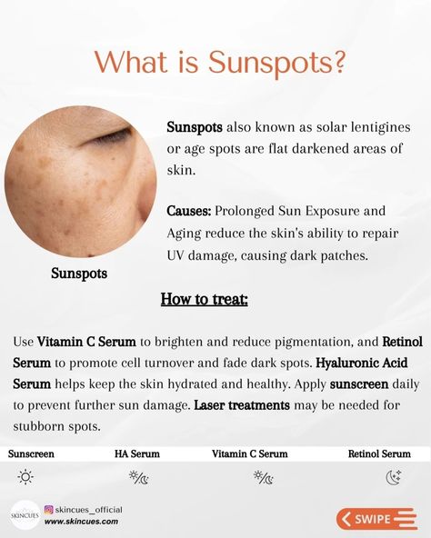 What is Sunspots? Hyperpigmentation Remedies, Skin Challenge, Spot Face, Sun Spot, Medical Aesthetics, Clear Skin Tips, Skin Glowing, Fade Dark Spots, Retinol Serum