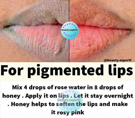 Lip Brightening, Ayurvedic Skin Care, Natural Skin Care Remedies, Clear Healthy Skin, Lip Care Routine, Natural Face Skin Care, Good Skin Tips, Skin Care Face Mask, Skin Care Diy