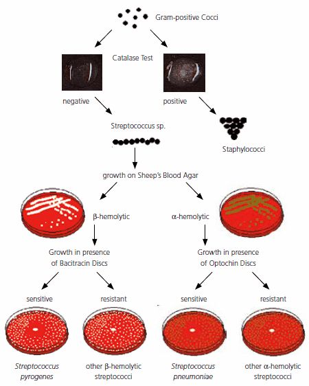 Streptococci - Overview of Detection, Identification, Differentiation and Cultivation Techniques | Sigma-Aldrich Medical Laboratory Science Student, Microbiology Study, Medical Lab Technician, Lab Humor, Medical Laboratory Technician, Microbiology Lab, Clinical Chemistry, Medical Laboratory Scientist, Laboratory Technician