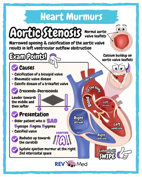 Which murmur would you like to see next? Comment it below ⤵️ Don’t forget to swipe this post and turn on the volume to listen 🩺 A whole lot of cardio is coming your way. Along with other topics only here 👉🏼 @rev.med Aortic Stenosis 🫀 High Yield ✅ Overview Type of heart valve disease (valvular heart disease). The valve between the lower left heart chamber and the body’s main artery (aorta) is narrowed and doesn’t open fully. This reduces or blocks blood flow from the heart to the aorta... Nclex Hacks, Right Coronary Artery, Heart Blood Flow, Cardiac Cath, Aortic Valve Stenosis, Heart Valves Mnemonics, Aortic Valve Stenosis Nursing, Coronary Angiography Views, Coronary Bypass Surgery Heart