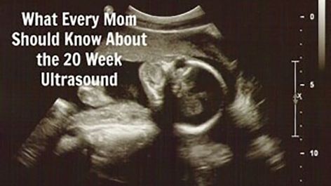 anatomy ultrasound 22 Week Ultrasound, 19 Week Ultrasound, 20 Week Ultrasound, Ultrasound Technologist, 16 Weeks Pregnant, Pregnancy Info, Baby Kicking, Pumping Moms, 20 Weeks