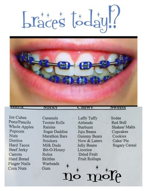 "I'm Getting Braces Today!" by avery333 ❤ liked on Polyvore Palette Expander Braces, Western Braces Colors, Braces Journey, Invisible Teeth Braces, Braces Care, Braces Ideas, Braces Food, Natural Teeth Whitening Diy, Cute Braces Colors