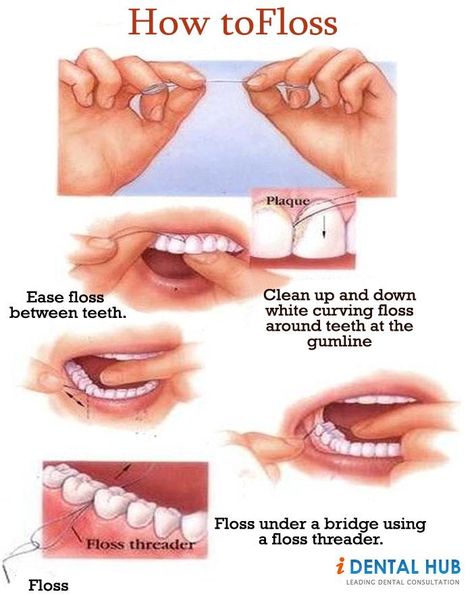 Dental Flossing, it is such a common thing but still many people donot floss thier teeth correctly. there are different kinds of dental flossing available im market. Using correct techinque to floss teeth is very important for oral hygiene. Dental Flossing, Floss Teeth, Flossing Teeth, Kedokteran Gigi, Dental Hygiene School, Dental Facts, Dental Products, Emergency Dentist, Teeth Health