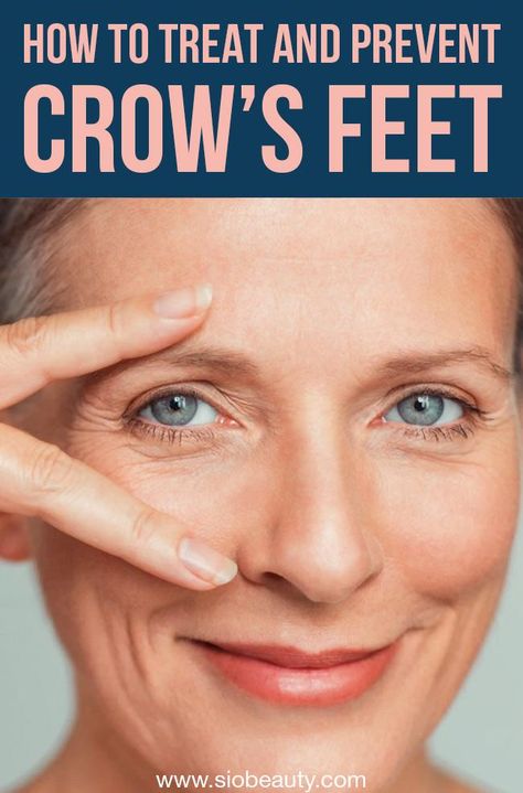 Eye Wrinkle Remedies, Crows Feet Wrinkles, Egg Nutrition, Wrinkle Remedies, Eye Wrinkles, Antiaging Skincare, Skin Bumps, Get Rid Of Wrinkles, Tongue Health