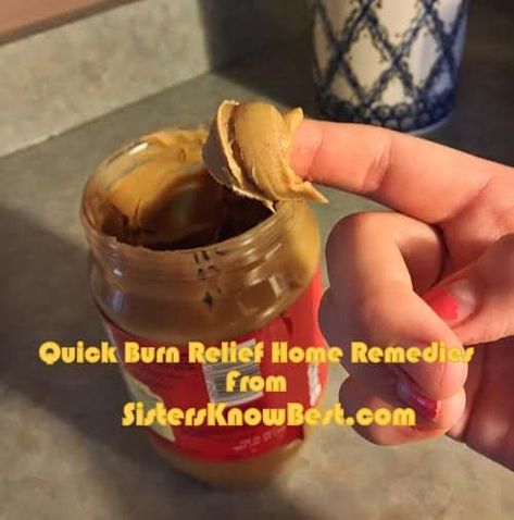 Diy Burn Relief, Burn Relief Skin, Burn Remedies, Home Remedies For Burns, Burn Remedy, Burn Relief, Brownie Recipes Healthy, Pumpkin Brownies, Carob Chips