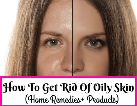 How To Get Rid Of Oily Skin Fast: Home Remedies & Products | Trabeauli Ubtan Recipe, Oily Forehead, Get Rid Of Oily Skin, Natural Hair Problems, 3c Natural Hair, Oily Skin Remedy, Face Sun, Natural Hair Regimen, Natural Glowing Skin