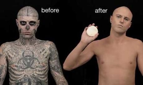 Dermablend before and after use Best Tattoo Cover Up Ever Cover Up Tattoos Before And After, Natural Tattoo Removal, Tatuaje Cover Up, Tattoo Cream, Tattoo Cover Up, Laser Tattoo, Laser Tattoo Removal, Tattoo Cover, Makeup Tattoos